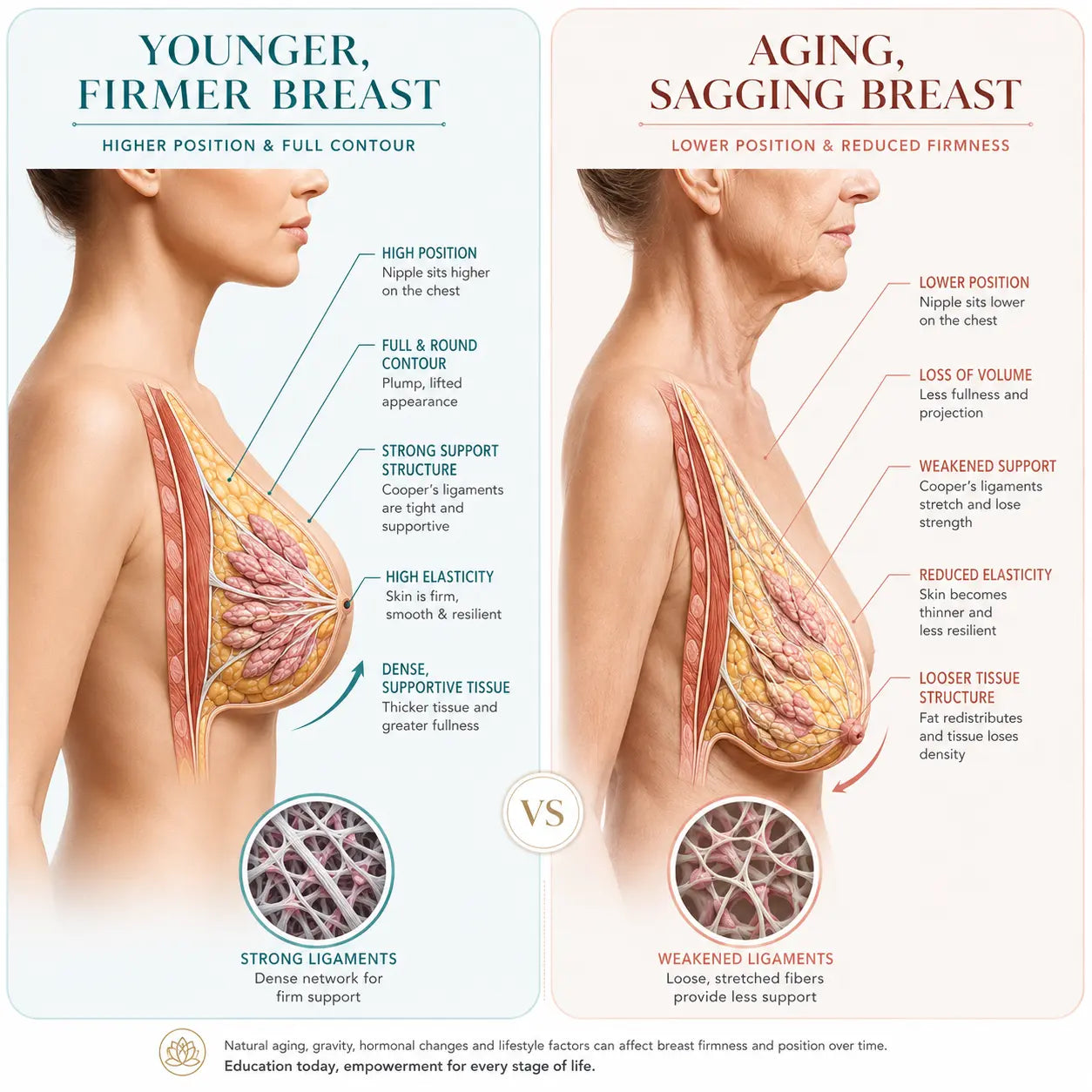 Last Day 80% OFF🔥Alcuras® Targeted Breast Enhancement Advanced Nano Microneedle Patch