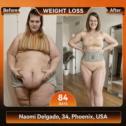 |Official Brand Store|🛡️Sfrcord® 2026 Moringa & Berberine 4-in-1 Micro-Particle Shaping & Fat Burning Shorts